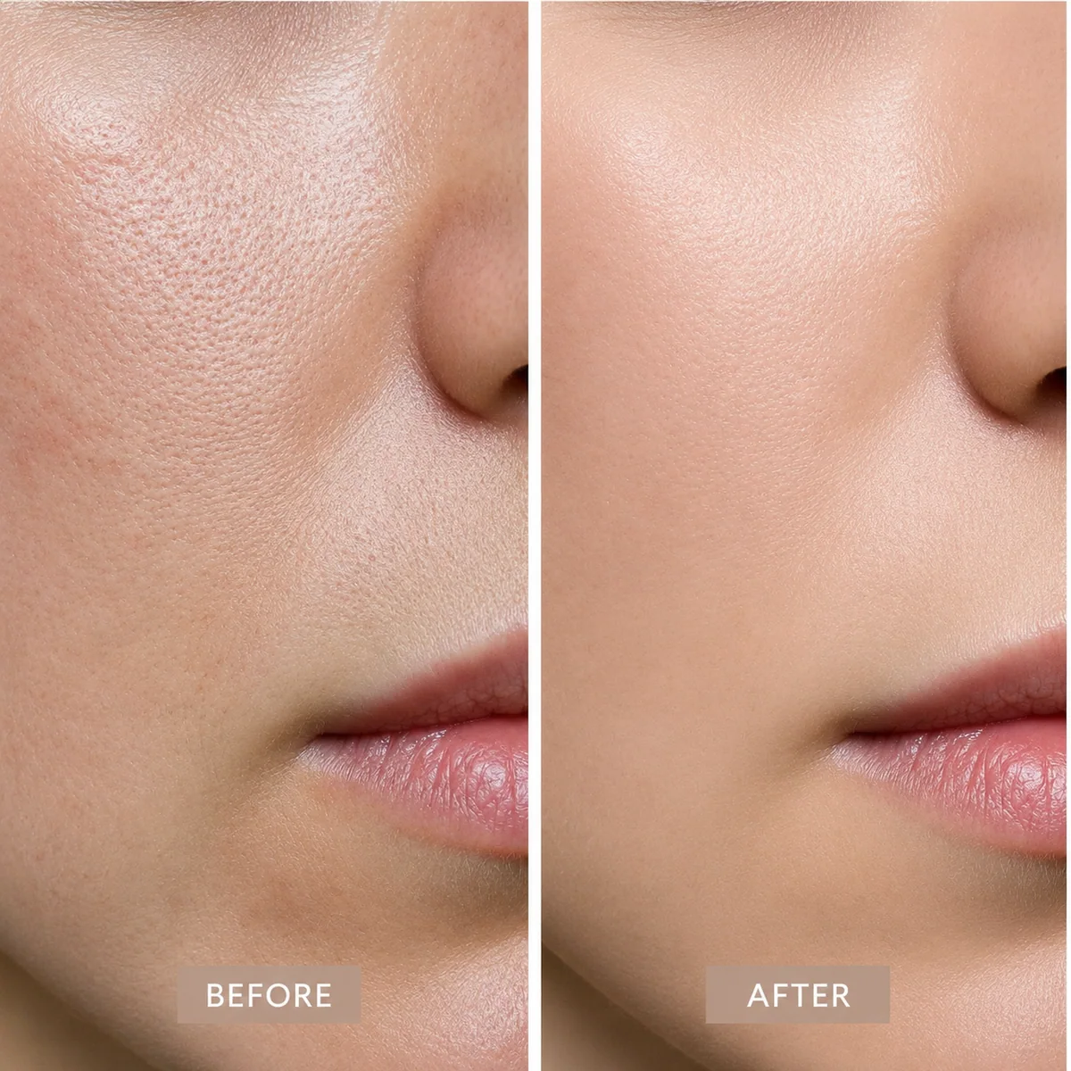 Illustrative comparison of skin texture before and after a course of treatment